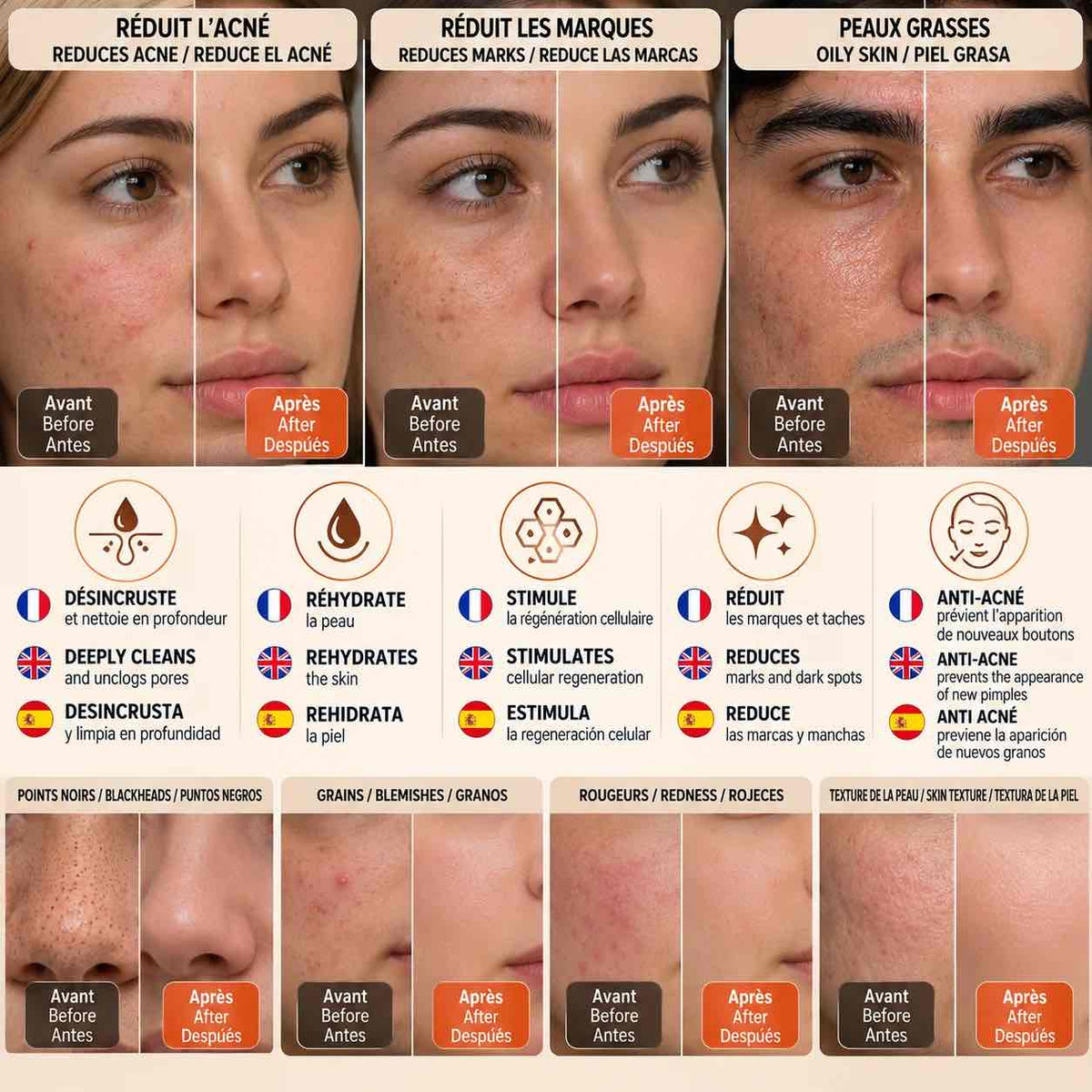 Crème au peeling doux appliquée en couche fine sur le visage pour une peau plus nette