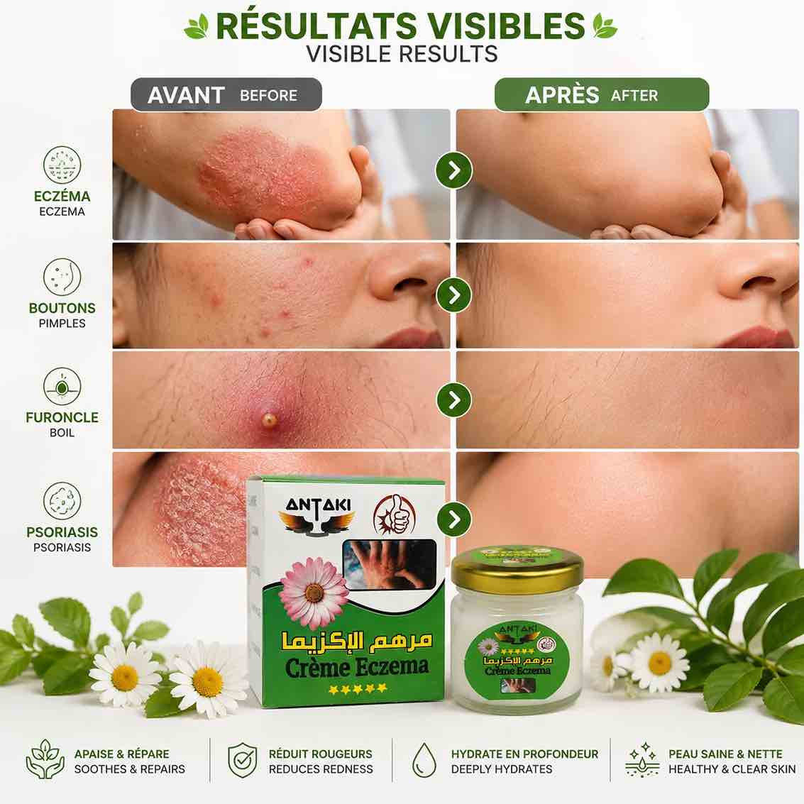 Crema ANTAKI 100g – Cuidado hidratante y calmante para pieles secas y sensibles