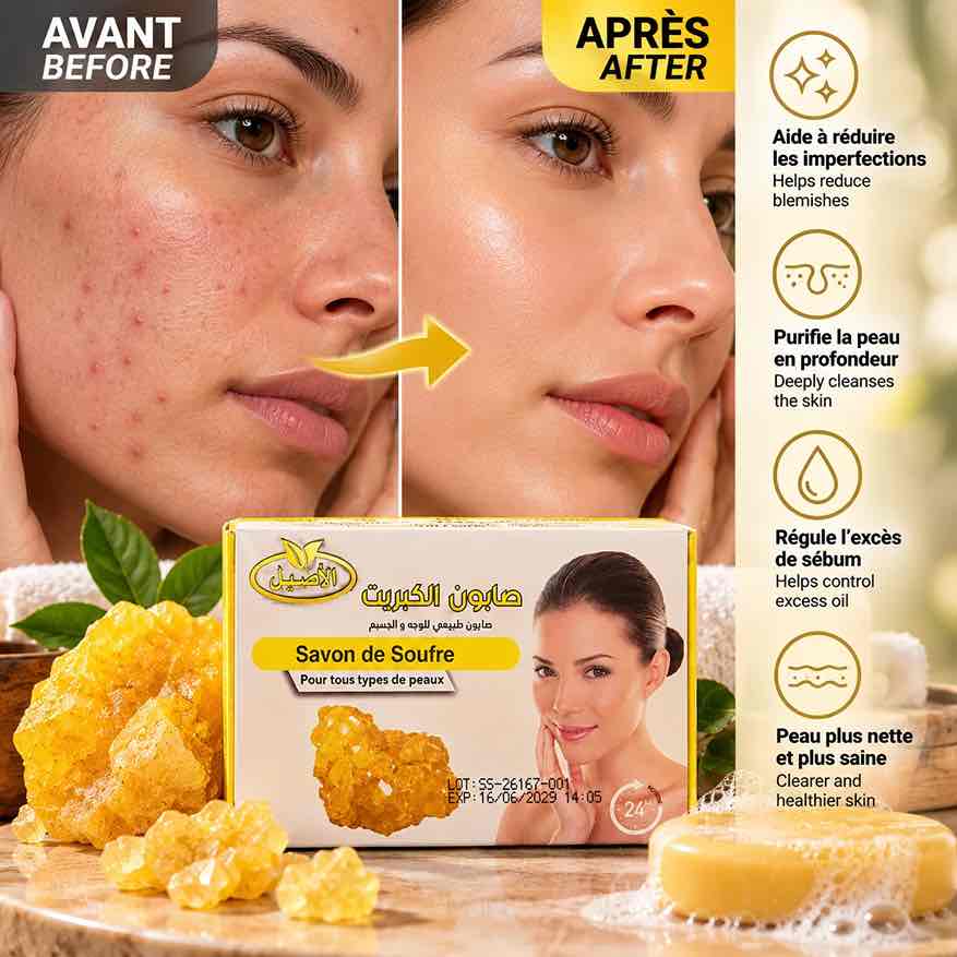 Savon au Soufre AL ASSILLE 125g – Purifiant Tous Types de Peau